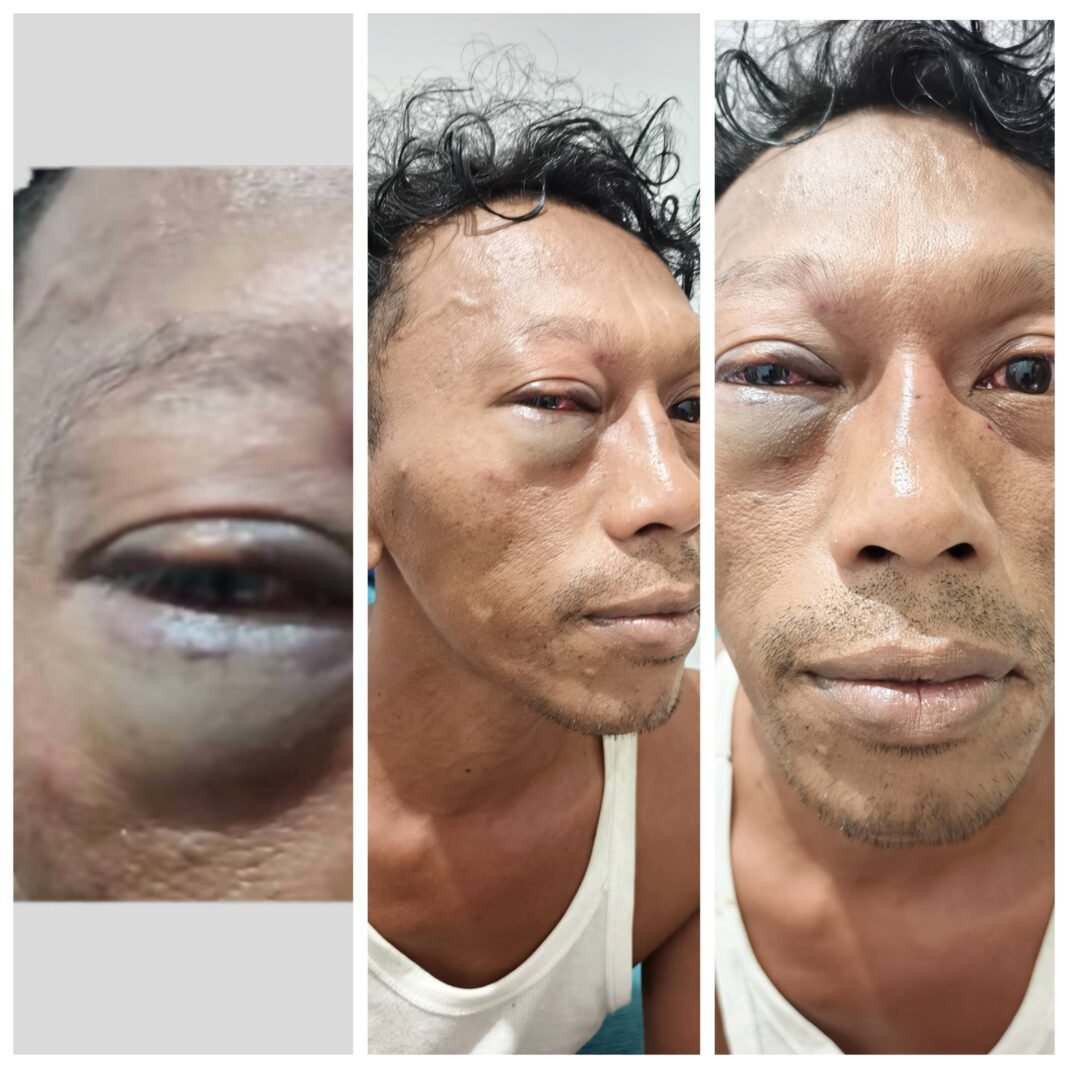 Sengketa Masjid Berujung Pengeroyokan, Diduga Ada Dalang Oknum Pengacara