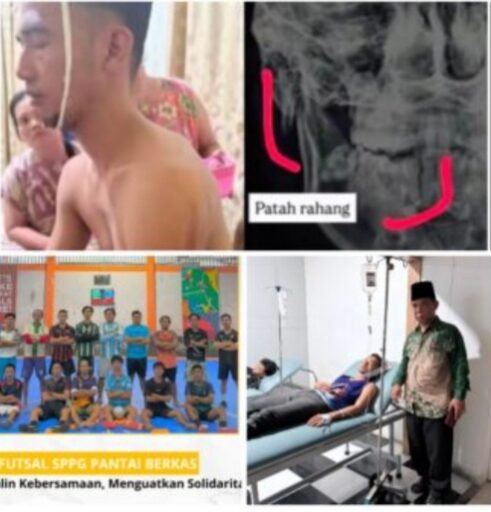 Heboh !!! Keluarga Desak Transparansi Hukum Terkait Dugaan Pengeroyokan oleh Oknum SPPG Pantai Berkas. Heboh !!! Keluarga Desak Transparansi Hukum Terkait Dugaan Pengeroyokan oleh Oknum SPPG Pantai Berkas.